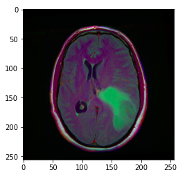 random image | Brain tumor detection