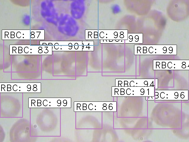 Implementing result of faster rcnn