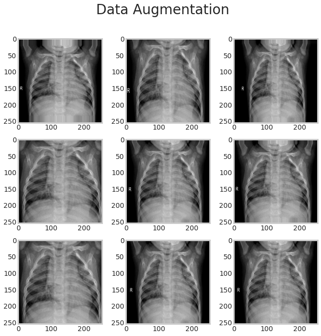 data augmentation