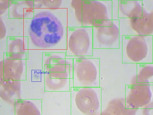 RBCs and WBCs in each image 