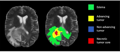 Medical Imaging