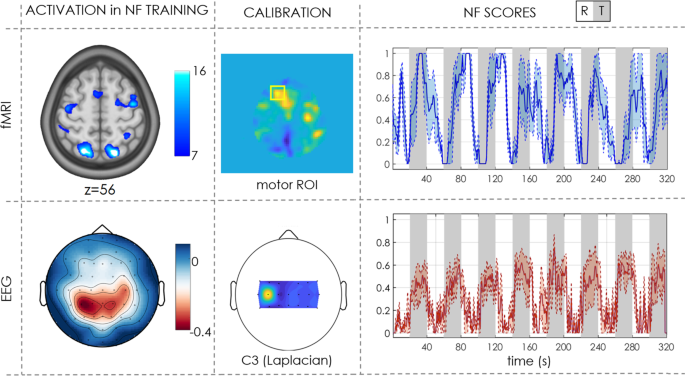 Morpheus uses  a unique neuroimaging technique, simultaneous EEG and fmri.