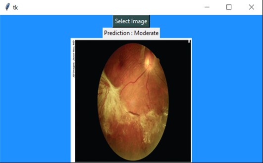 image 2 | Ensemble Deep Learning