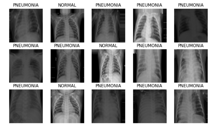 Pretrained-Stacked Model | X-rays 2