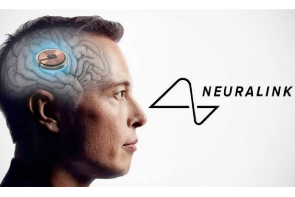 Neuralink's First Brain Implant